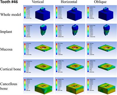 Biomechanical Comparison of Six Different Root-Analog Implants and the Conventional Morse Taper Implant by Finite Element Analysis